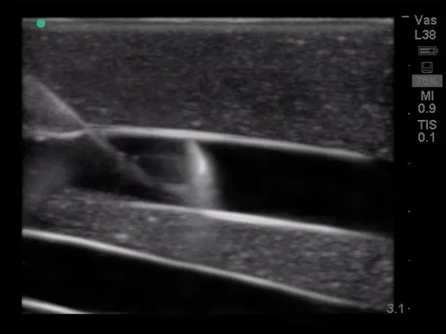 Internal Jugular Central Line Ultrasound Manikin